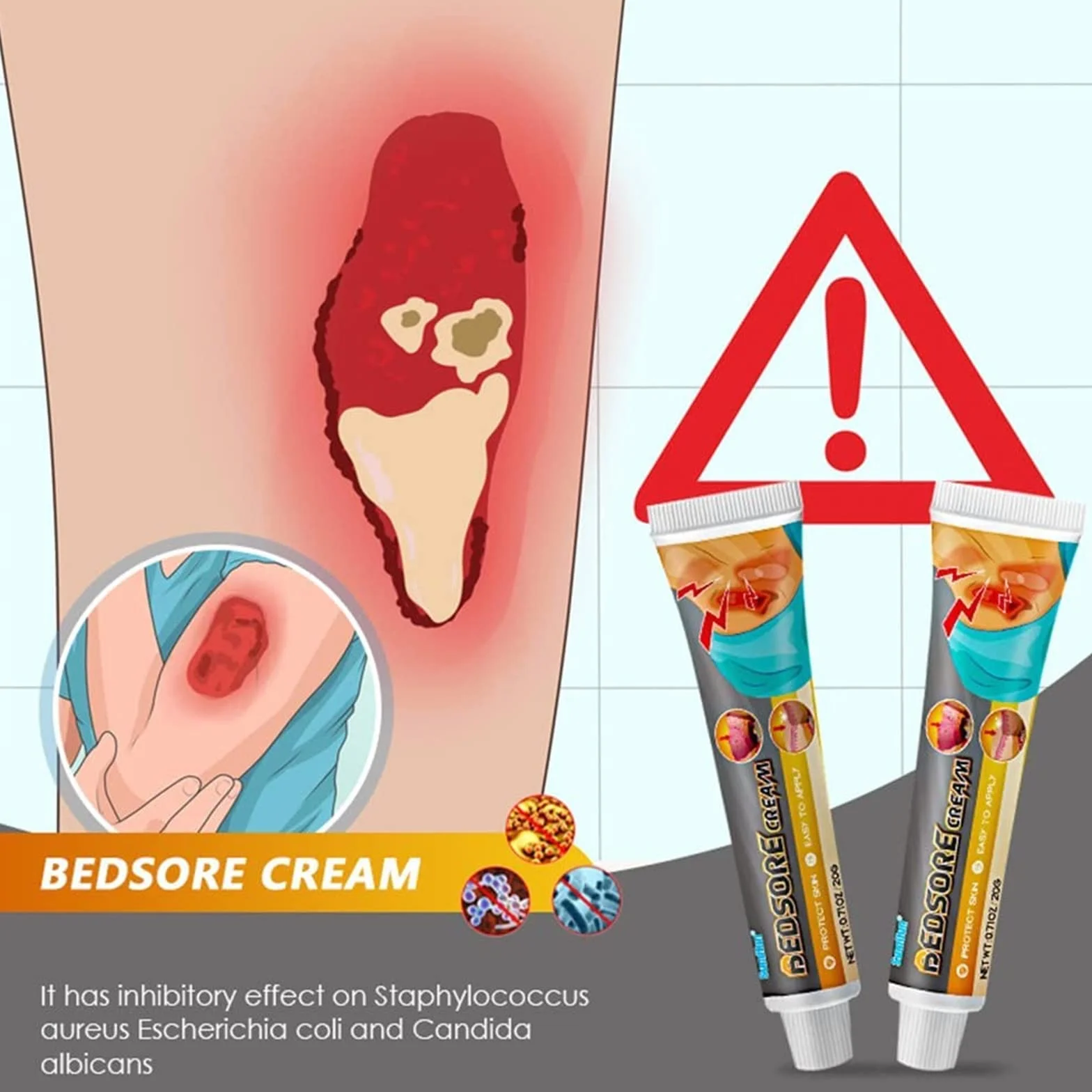 Krem do leczenia bólu łóżka, organiczny odleżyn, maść, odleżyna, krem łagodzący ból odleżyn, pielęgnacja ran w leczeniu odleżyn, leczenie odleżyn, gojenie się ran