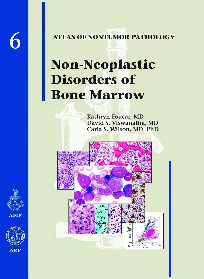 Non-Neoplastic Diseases of Bone Marrow: No 6
