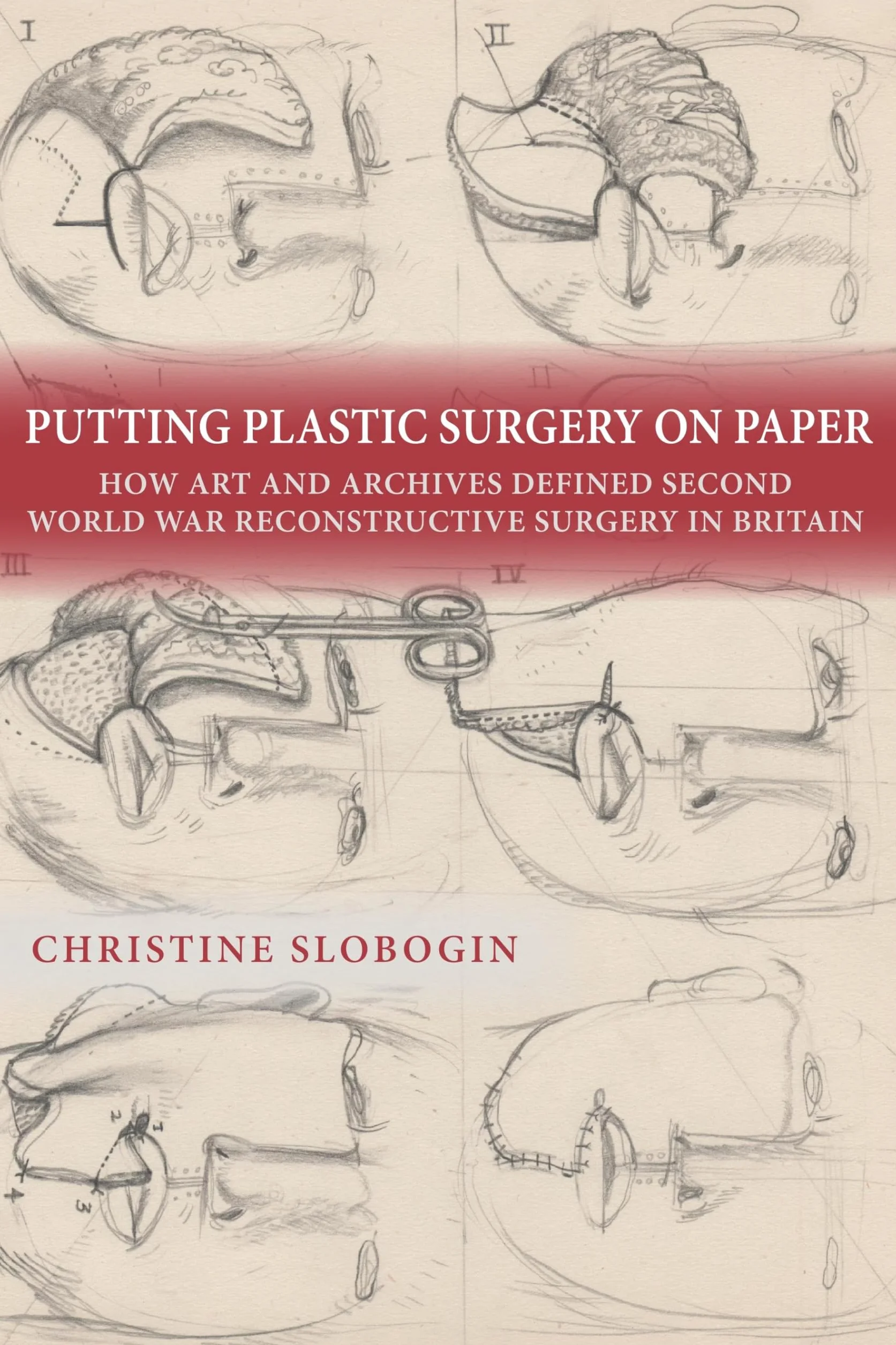 Putting Plastic Surgery on Paper: How Art and Archives Defined Second World War Reconstructive Surgery in Britain