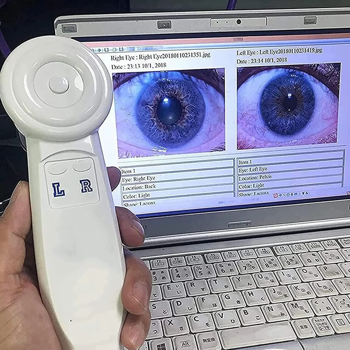 Analizator tęczówki USB Irydoskop, kamera o wysokiej rozdzielczości z obiektywem HD 30x Iris i oprogramowaniem do analizy, precyzyjna kamera irydologiczna do szczegółowego badania wzroku.