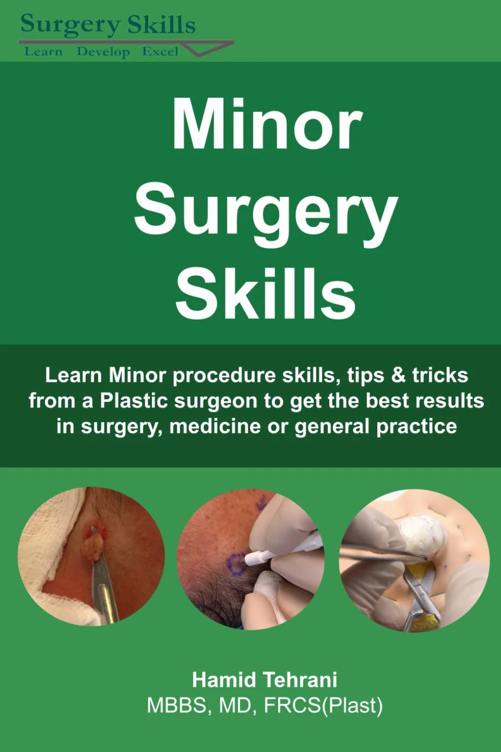 Minor Surgery Skills: learn Minor Procedure skills, tips & tricks from a Plastic surgeon to get the best results in surgery, medicine or general practice