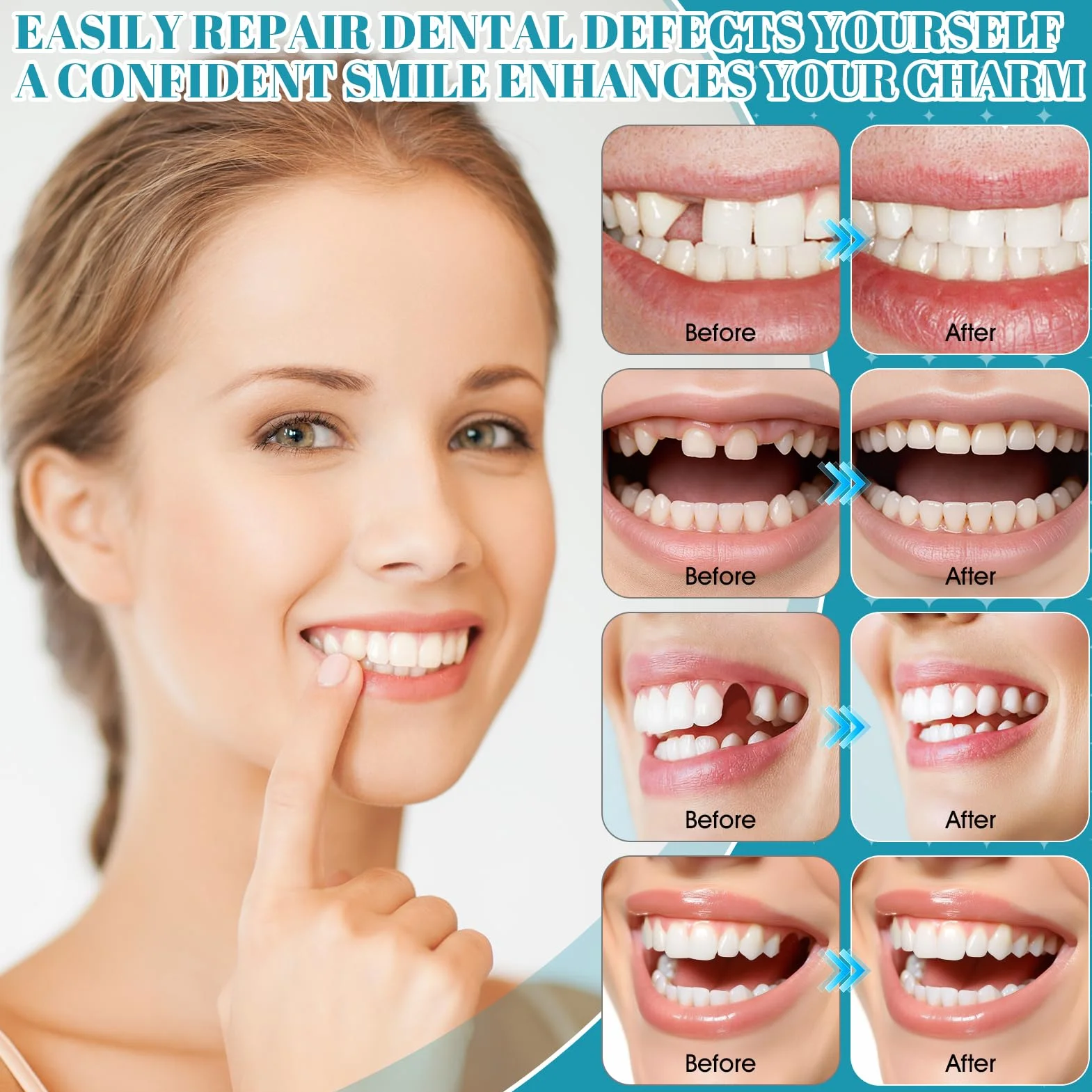 Cement dentystyczny, trwały, klej do zębów, do koron, protez zębowych, roztwór do koron, mostków, próchnicy zębów i zagubionych wypełnień