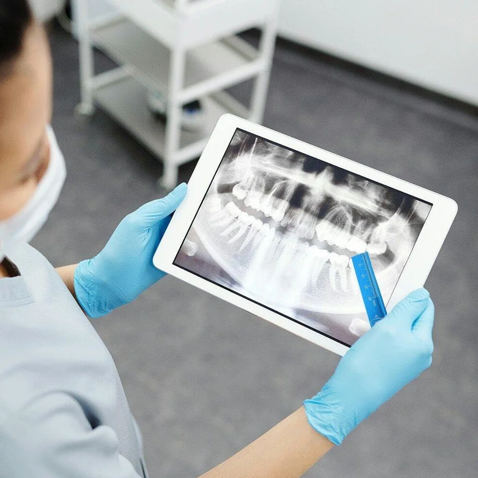 Linijka dentystyczna precyzyjna miarka dentystyczna miarka endodontyczna skala pomiarowa miernik ustny narzędzie stomatologiczne do stomatologii