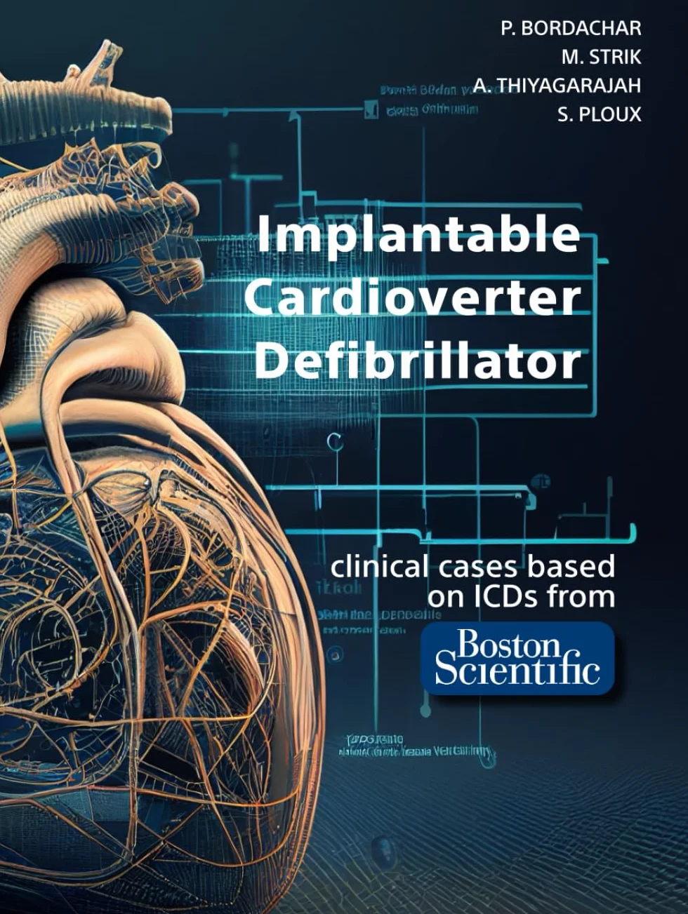 Implantable Cardioverter Defibrillator: based on clinical cases from Boston Scientific ICDs