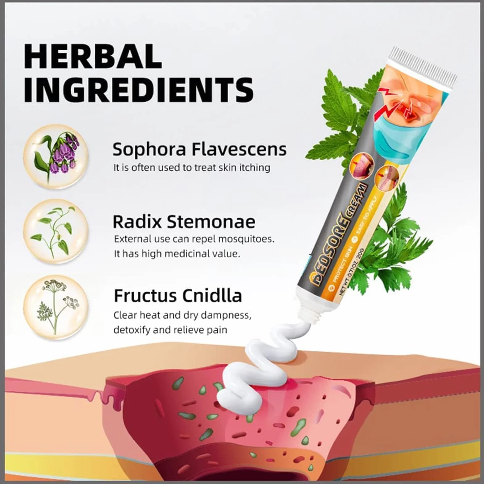 Krem do leczenia bólu łóżka, organiczny odleżyn, maść, odleżyna, krem łagodzący ból odleżyn, pielęgnacja ran w leczeniu odleżyn, leczenie odleżyn, gojenie się ran