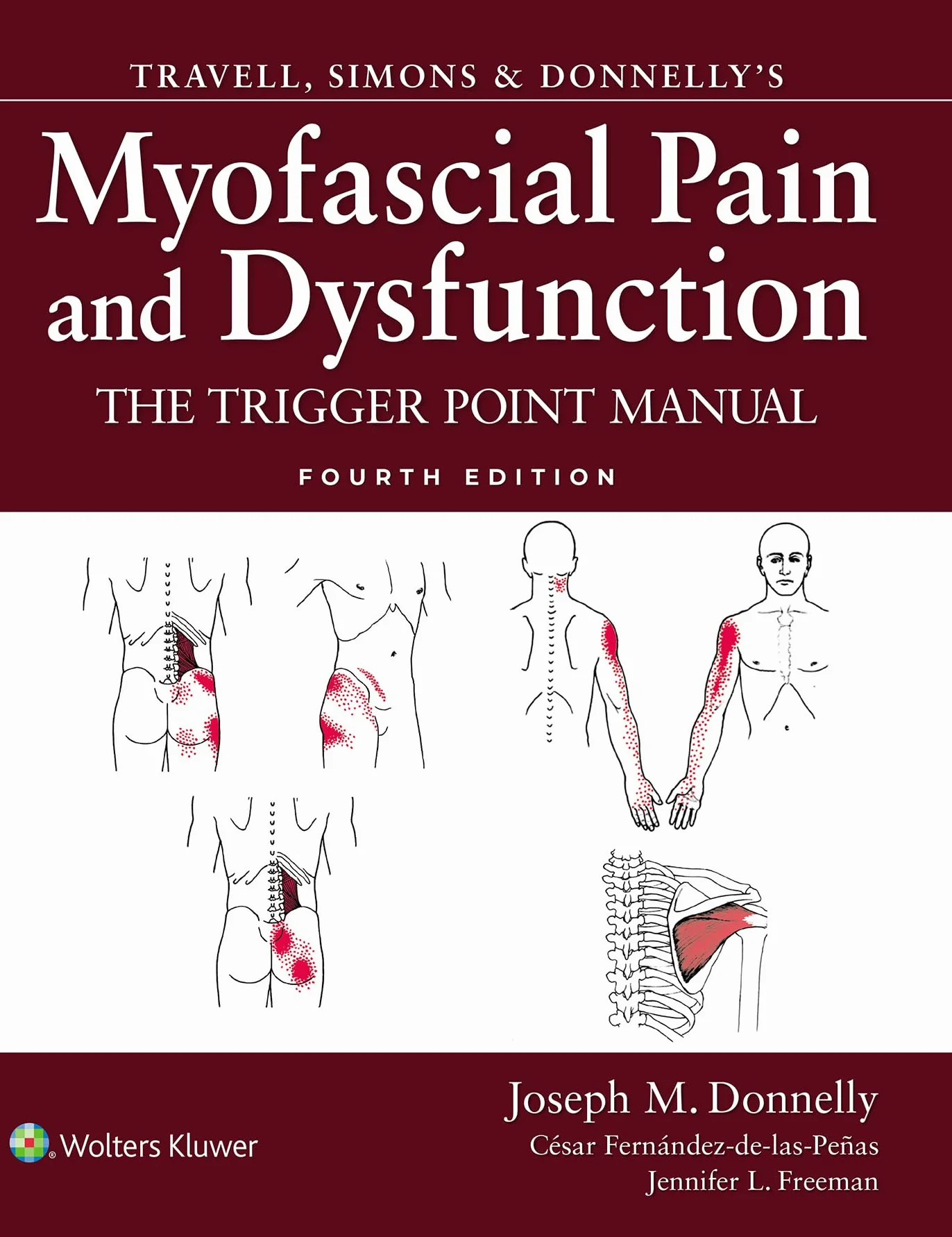 Travell, Simons & Donnelly's Myofascial Pain and Dysfunction: The Trigger Point Manual