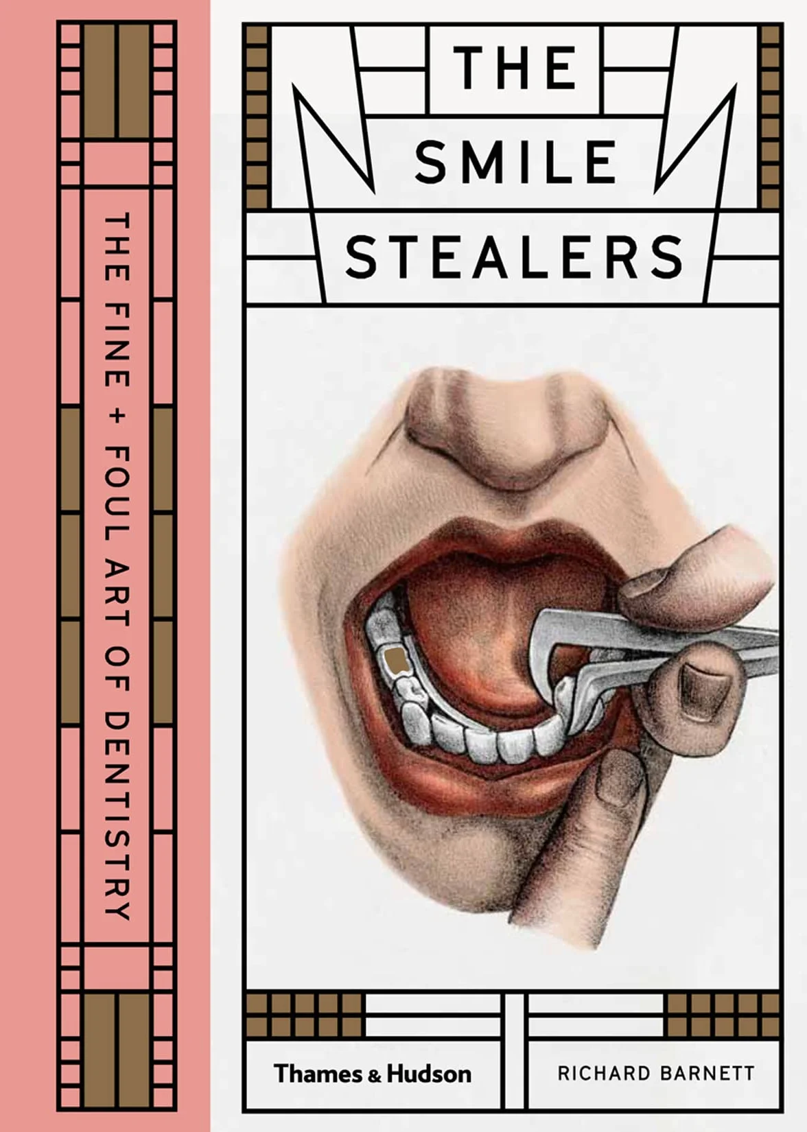 Smile Stealers: The Fine and Foul Art of Dentistry