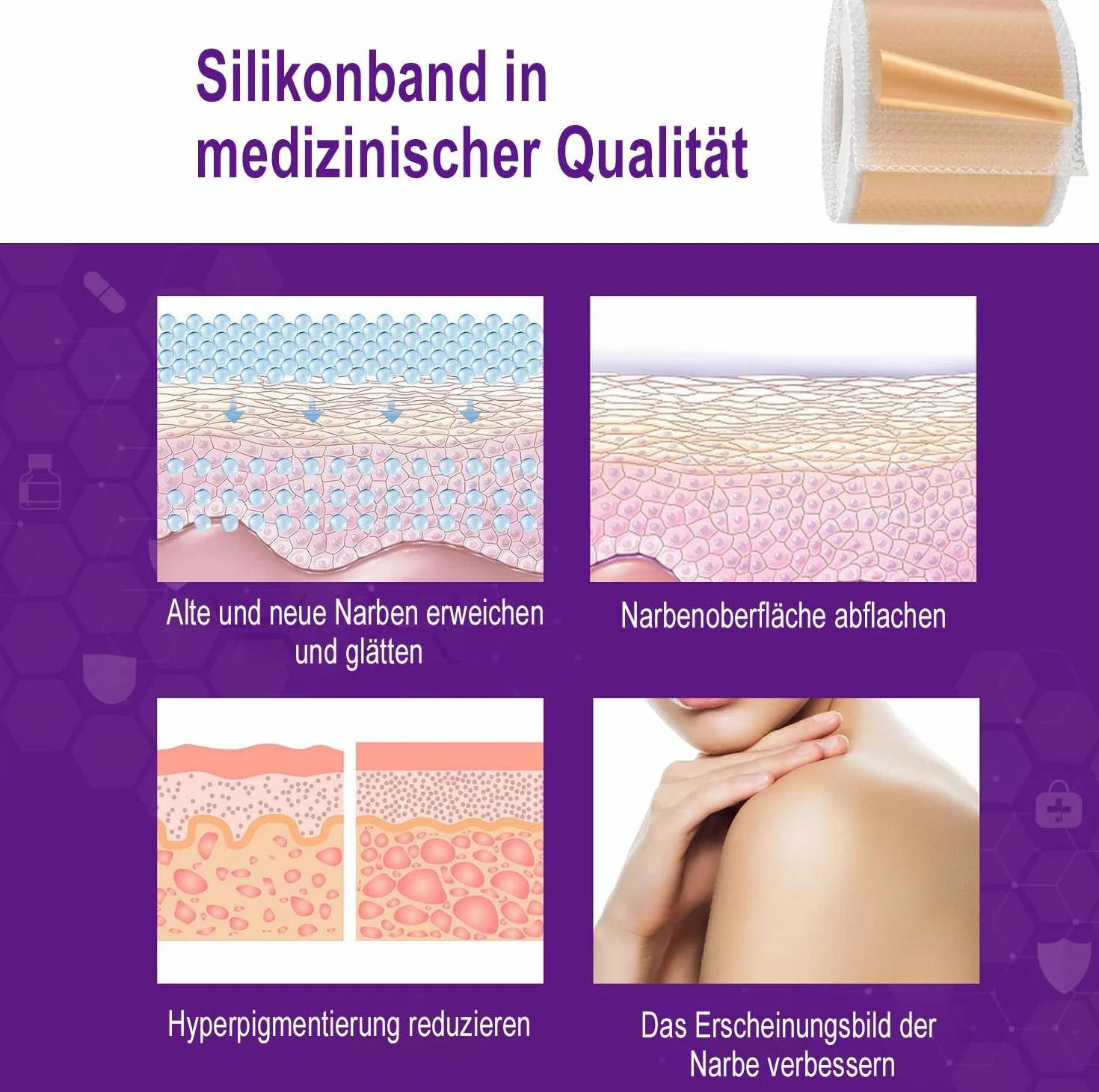 Paski silikonowe (4 cm x 1,5 m) – miękki żel silikonowy, wielokrotnego użytku, do pielęgnacji skóry