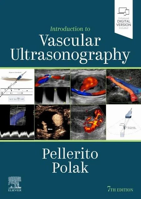 Introduction to Vascular Ultrasonography: Expert Consult - Online and Print