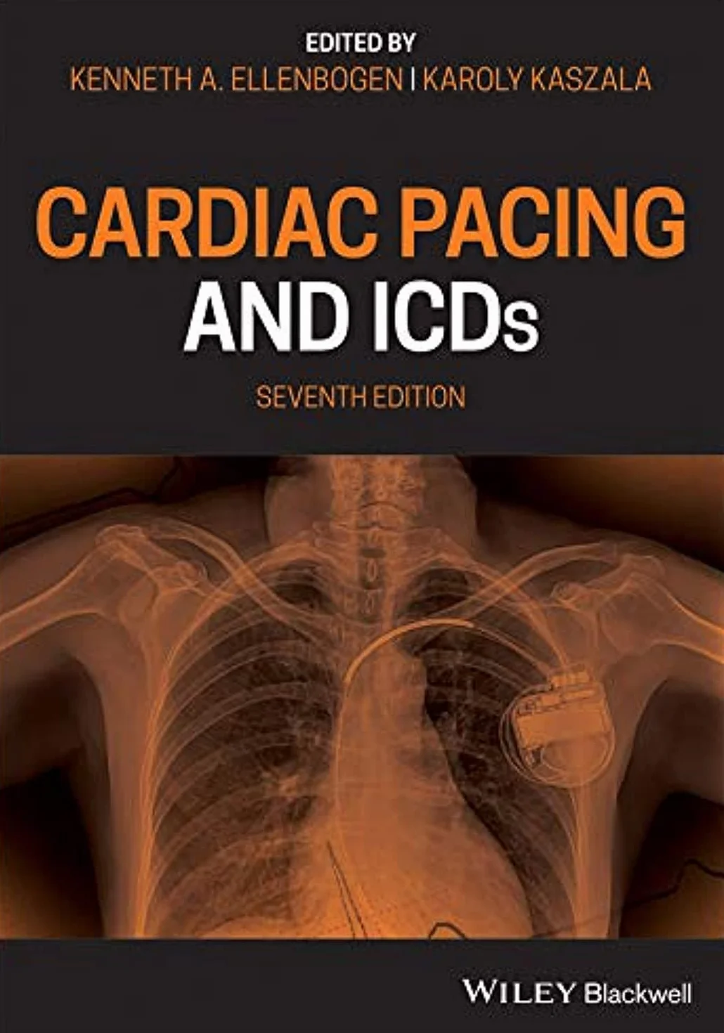 Cardiac Pacing and Icds